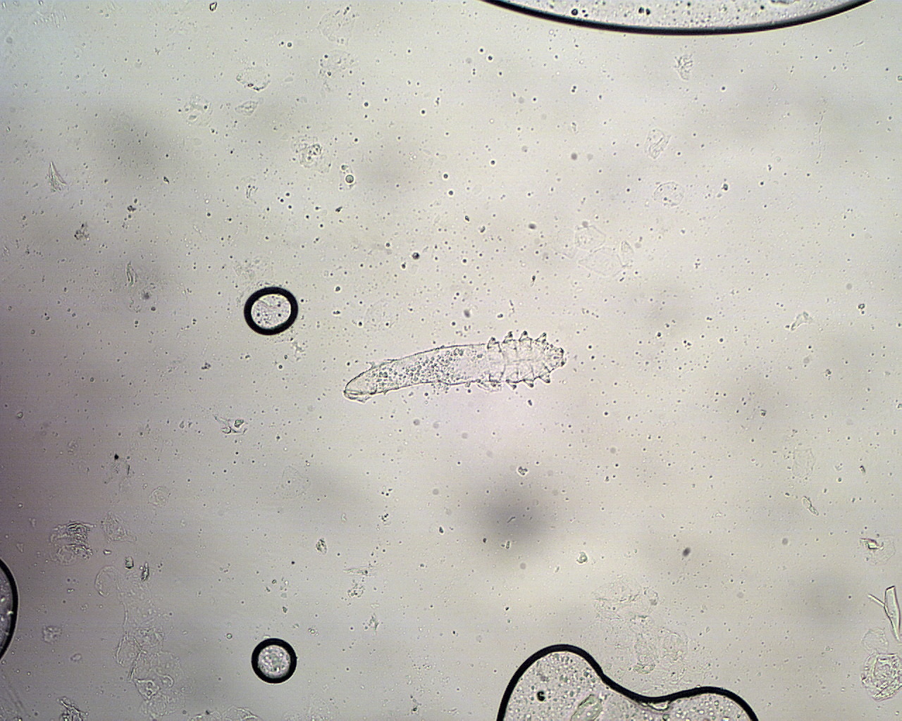 Demodex